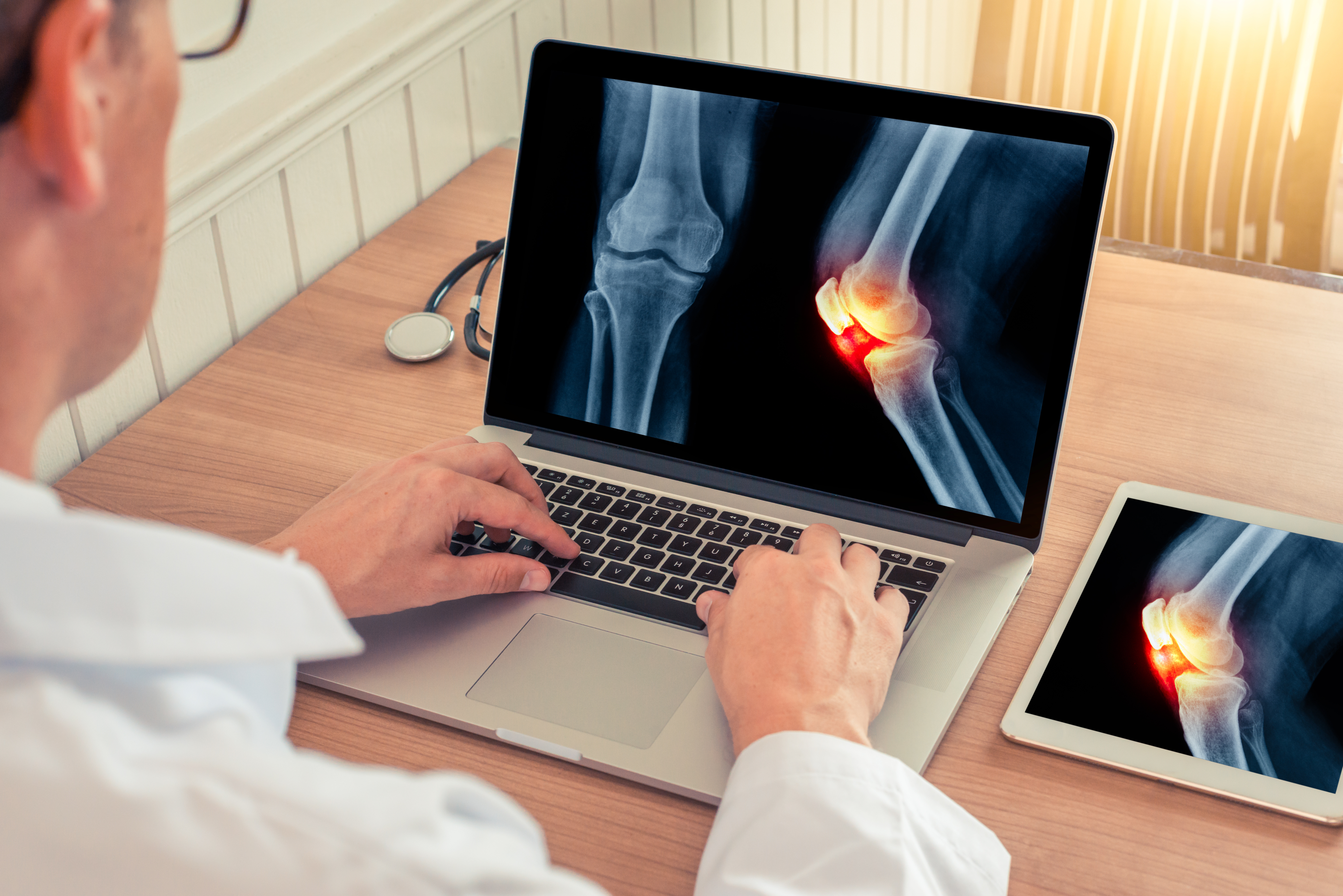 Person viewing knee X-ray images on a laptop and tablet.
